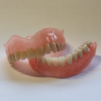 Totale Prothese